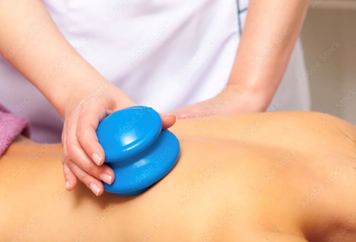 Cupping That Doesn't Leave Marks