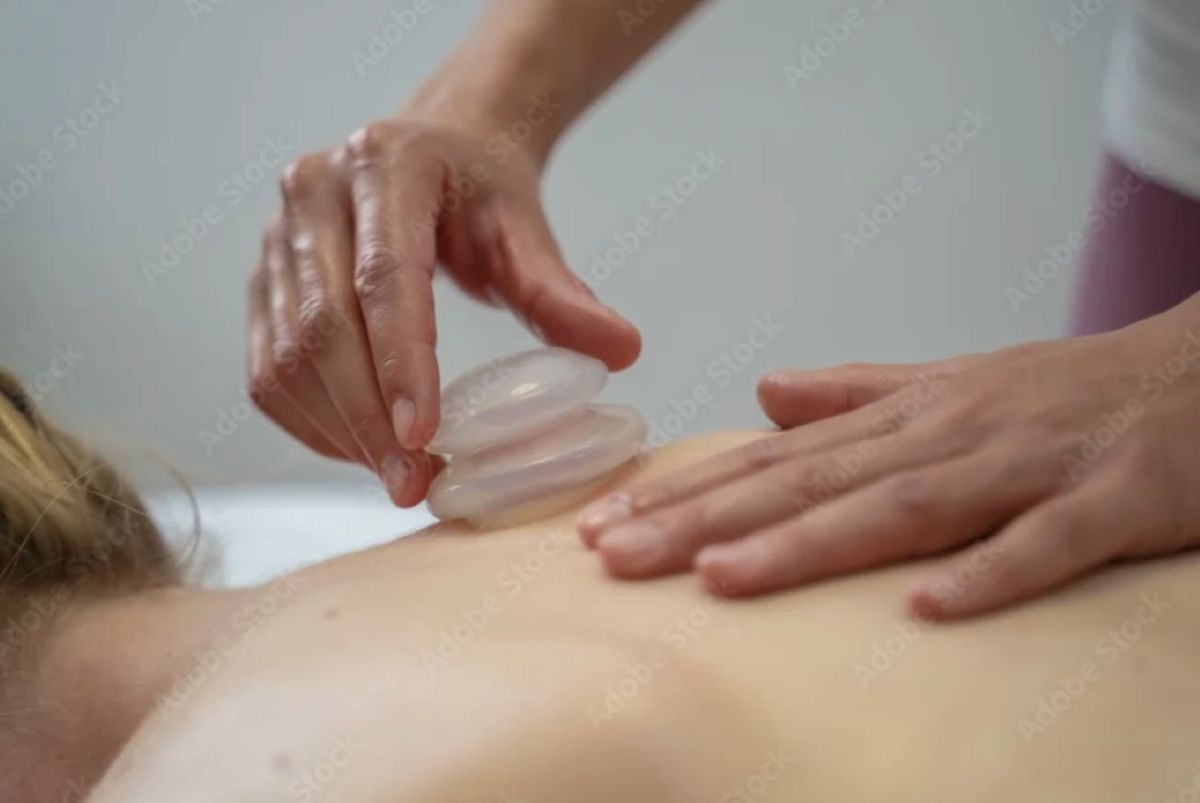 Cupping Therapy Alpharetta GA